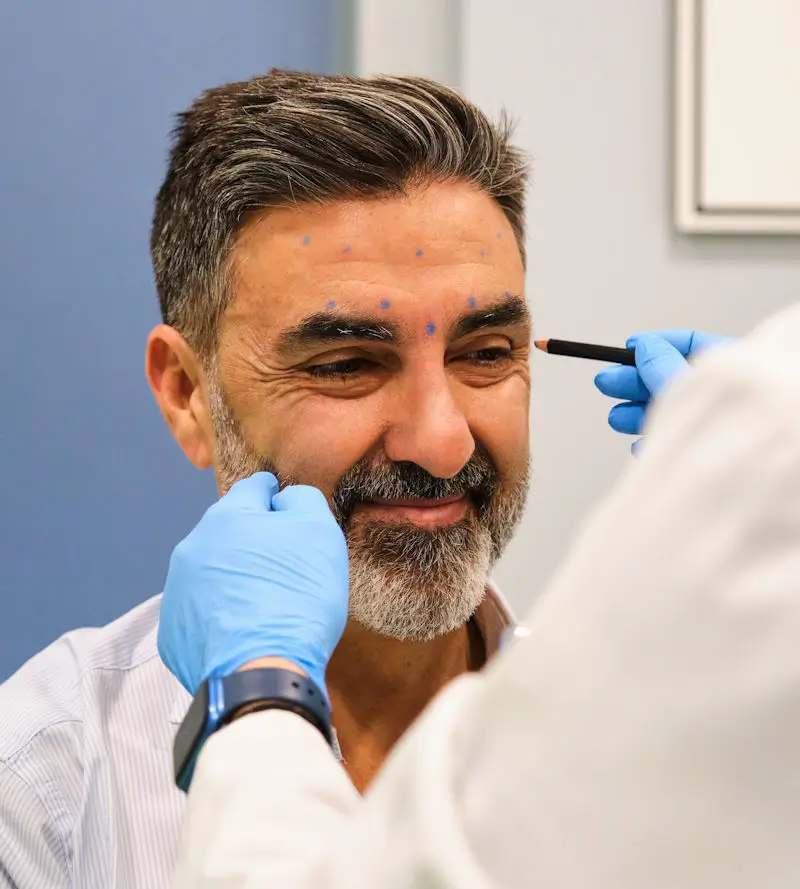 Krähen beim Mann: Präzise Behandlung in Frankfurt. Ein Mann wird für die Behandlung der Krähenfüße mit Botox oder Hyaluron in der Praxis von Schumann Aesthetics in Frankfurt eingezeichnet